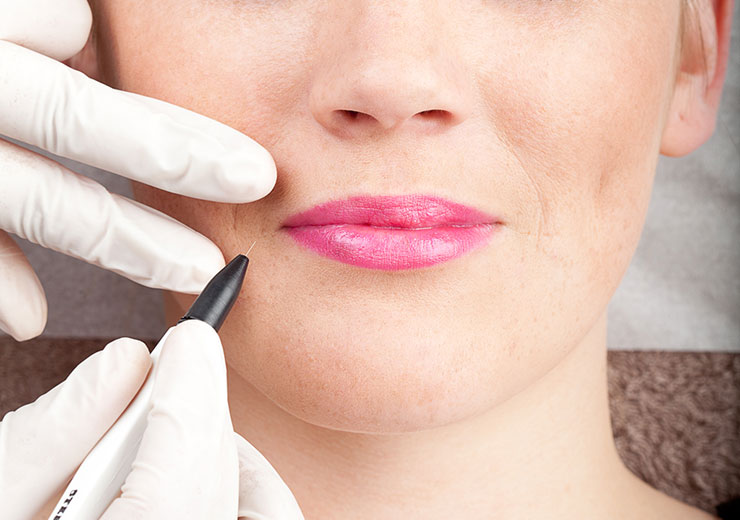 depilación eléctrica en pamplona