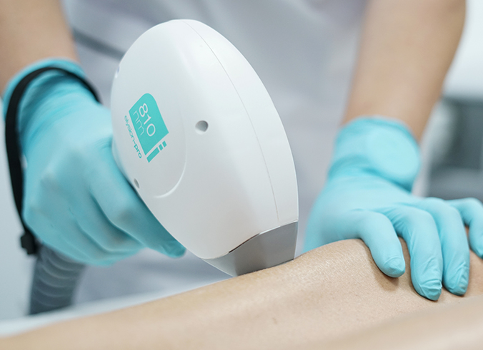 depilación laser en pamplona